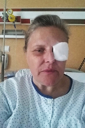 Imagen Una joven de Priego pierde su ojo izquierdo tras recibir un impacto mientras se bañaba en la playa de la Carihula en Torremolinos